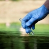 شرکت خدمات سلامت قزوین، خدمات خود کنترلی و خود اظهاری بهداشت