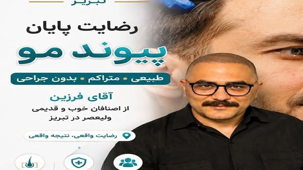 کاشت مو با بهترین نتیجه در تبریز و روش های مراقبت بعد از کاشت