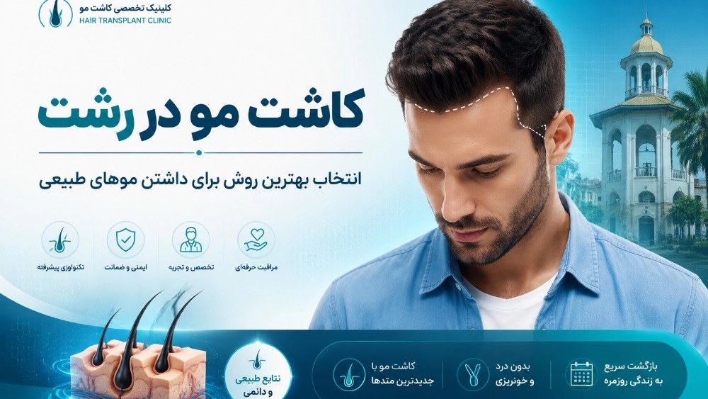 کاشت مو در رشت انتخاب بهترین روش برای داشتن موهای طبیعی