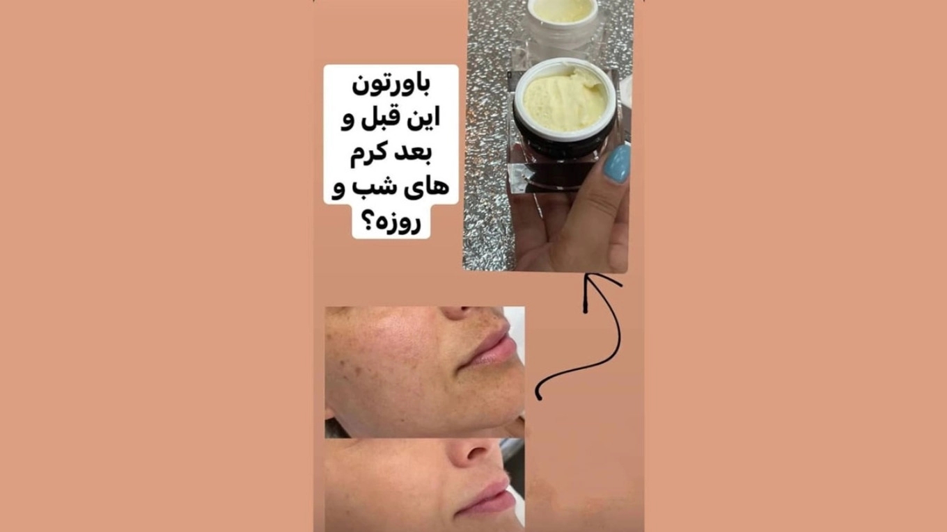 کرم روز لاکچری کوین