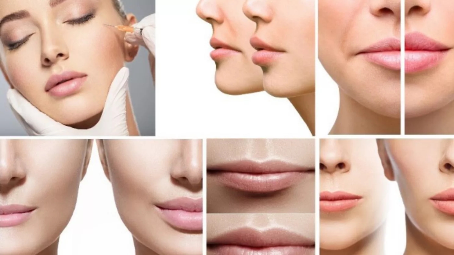 تاثیر تزریق ژل و تزریق بوتاکس در رفع خطوط و چین و چروک صورت و میزان ماندگاری آنها