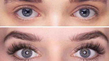 کاشت مژه موقت، راه حل سریع برای داشتن ظاهری زیبا