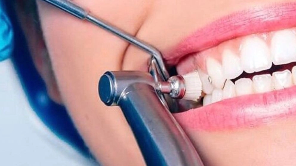 چگونه زیبایی دندان خود را بازسازی کنیم؟