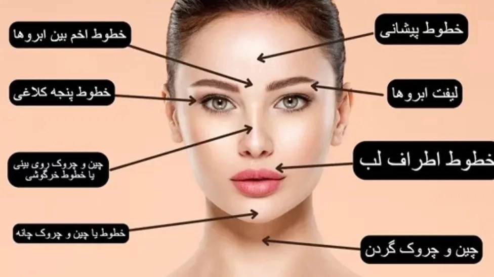 مراقبت های مهم و ضروری بعد از تزریق بوتاکس