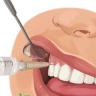 تجهیزات دندانپزشکی حیان، پخش سرسوزن تزریق کارتریج و گوتای متا در قم