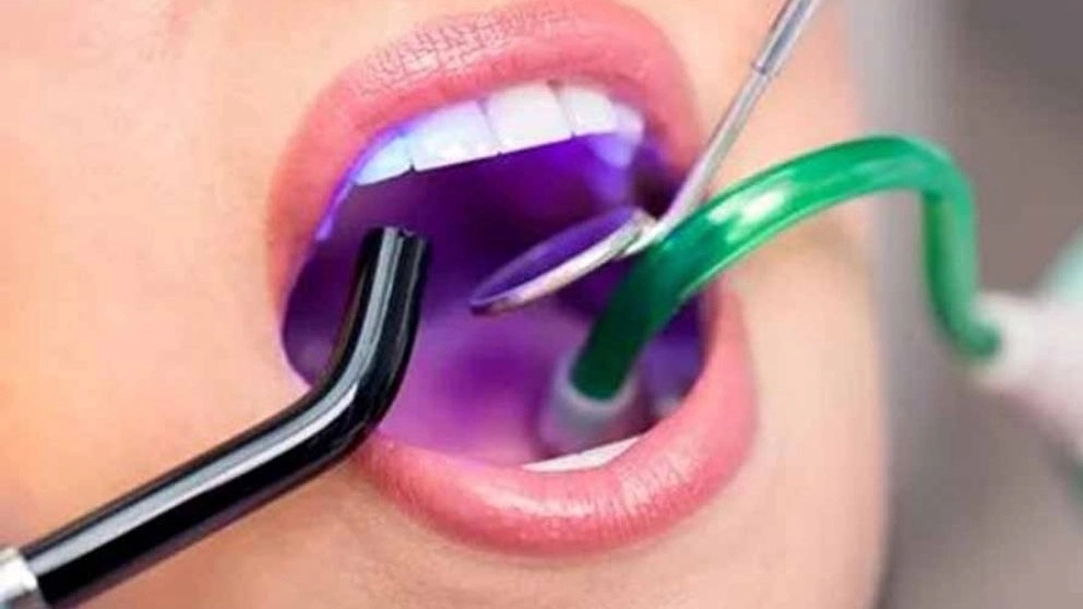 لیست اصلی ترین تجهیزات دندانپزشکی