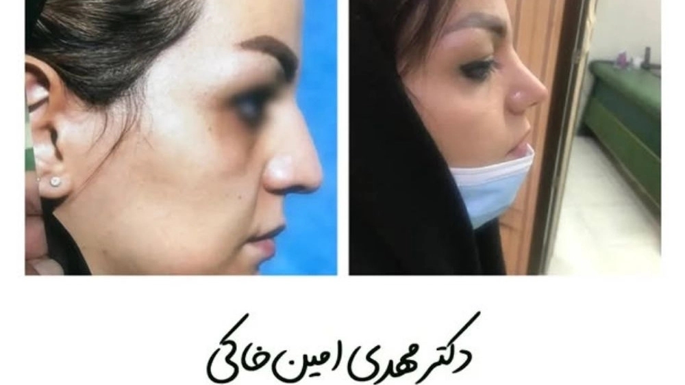 دکتر مهدی امین خاکی، فوق تخصص جراحی پلاستیک و زیبایی در کرج