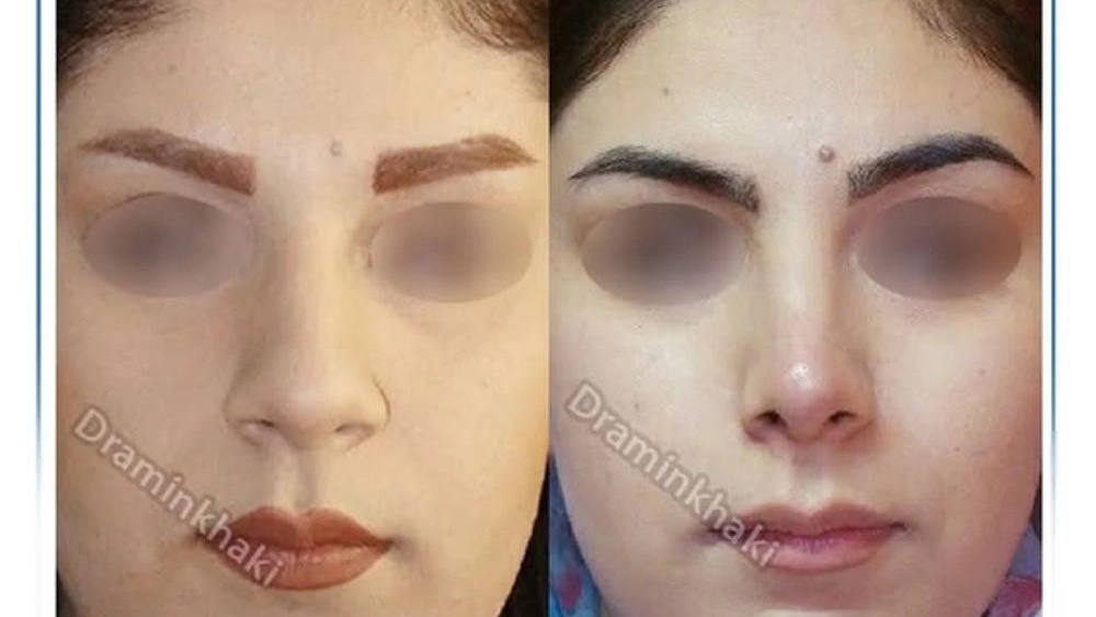 جراح پلاستیک و زیبایی در کرج و تهران