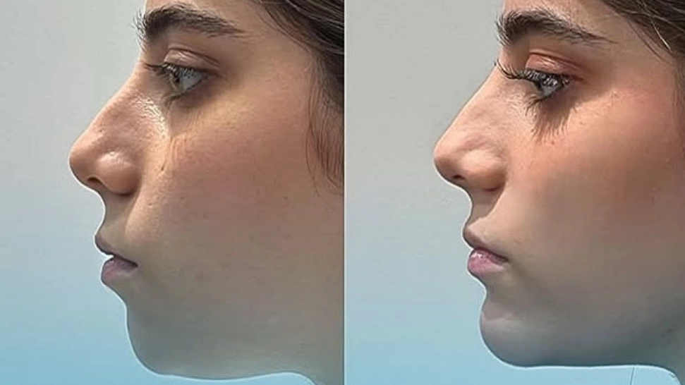خدمات زیبایی و جوانسازی پوست در کرمانشاه