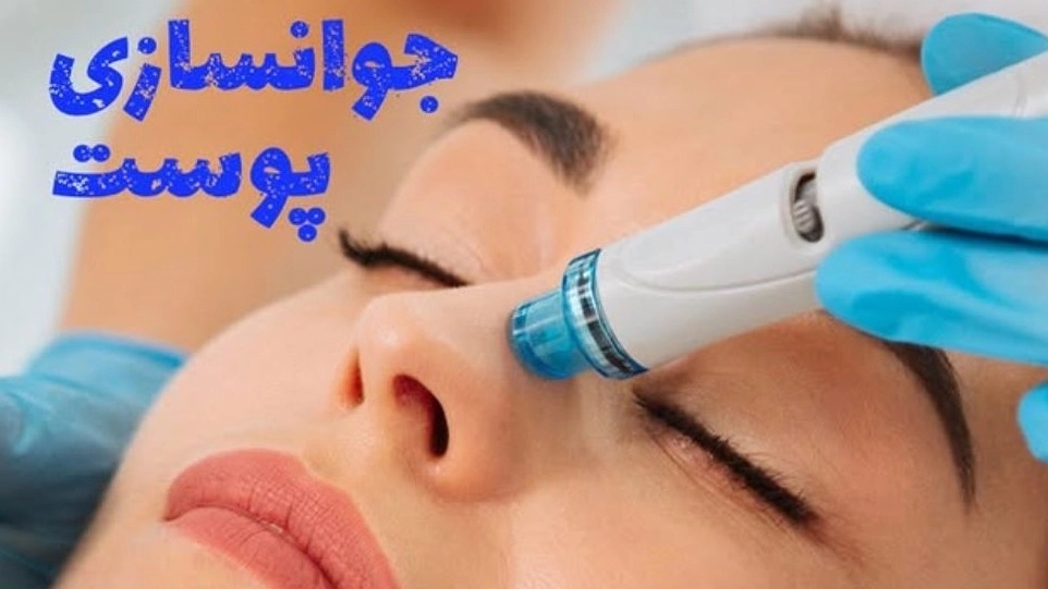 فیلینگ و جوانسازی پوست در مرکز فیشیال وفایی