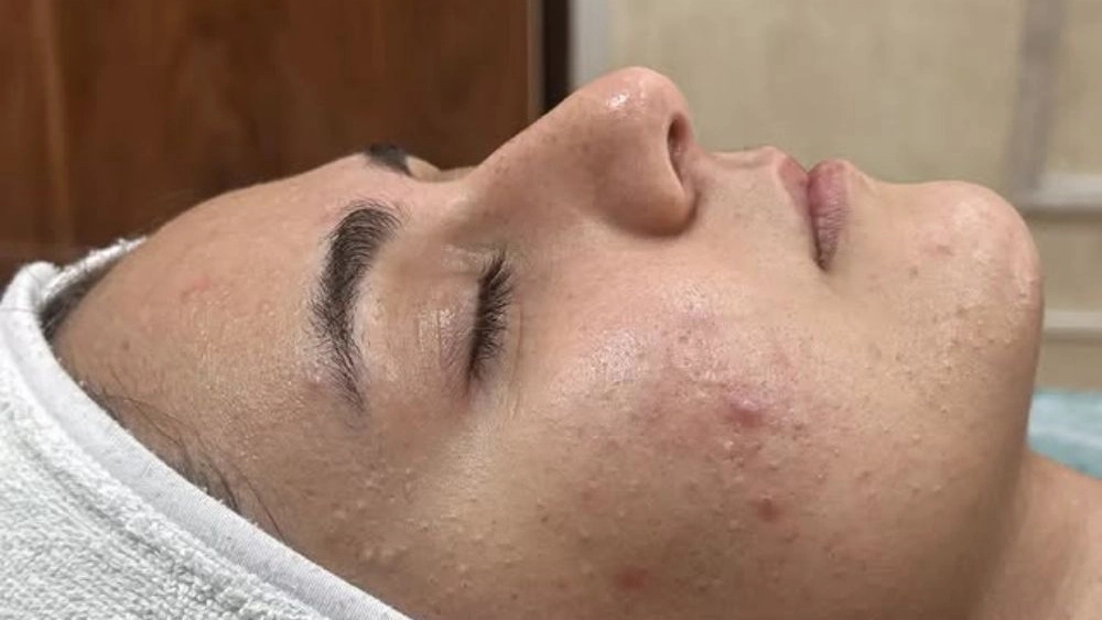 بهترین مرکز خدمات تخصصی پوست در کرمانشاه