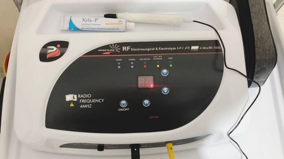 خدمات خالبرداری با دستگاه RF surgical در صومعه سرا