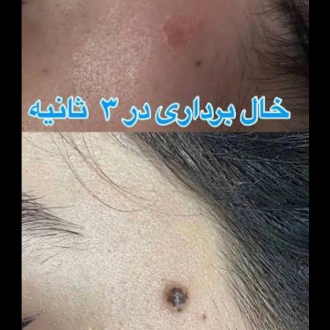 1777362743699.webp