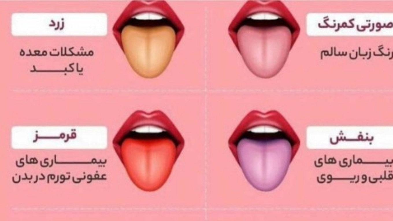تشخیص کبد چرب از روی زبان
