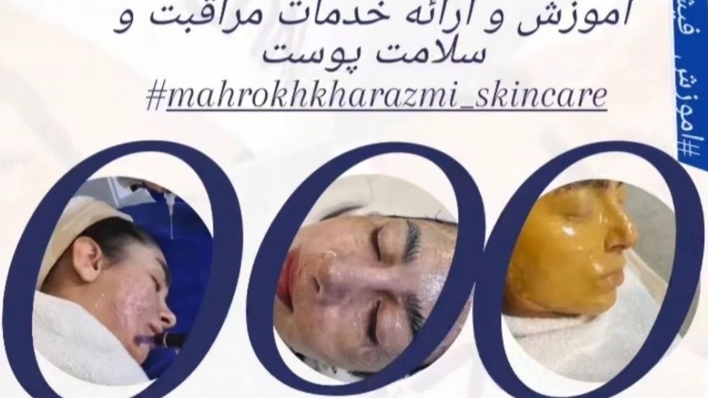 فیشال چیست