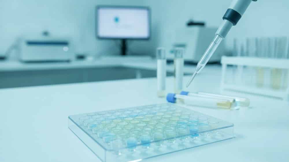 تست ELISA طیور برای تشخیص بیماری‌های عفونی در کرج
