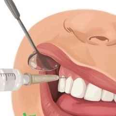 تجهیزات دندانپزشکی حیان، پخش سرسوزن تزریق کارتریج و گوتای متا در قم