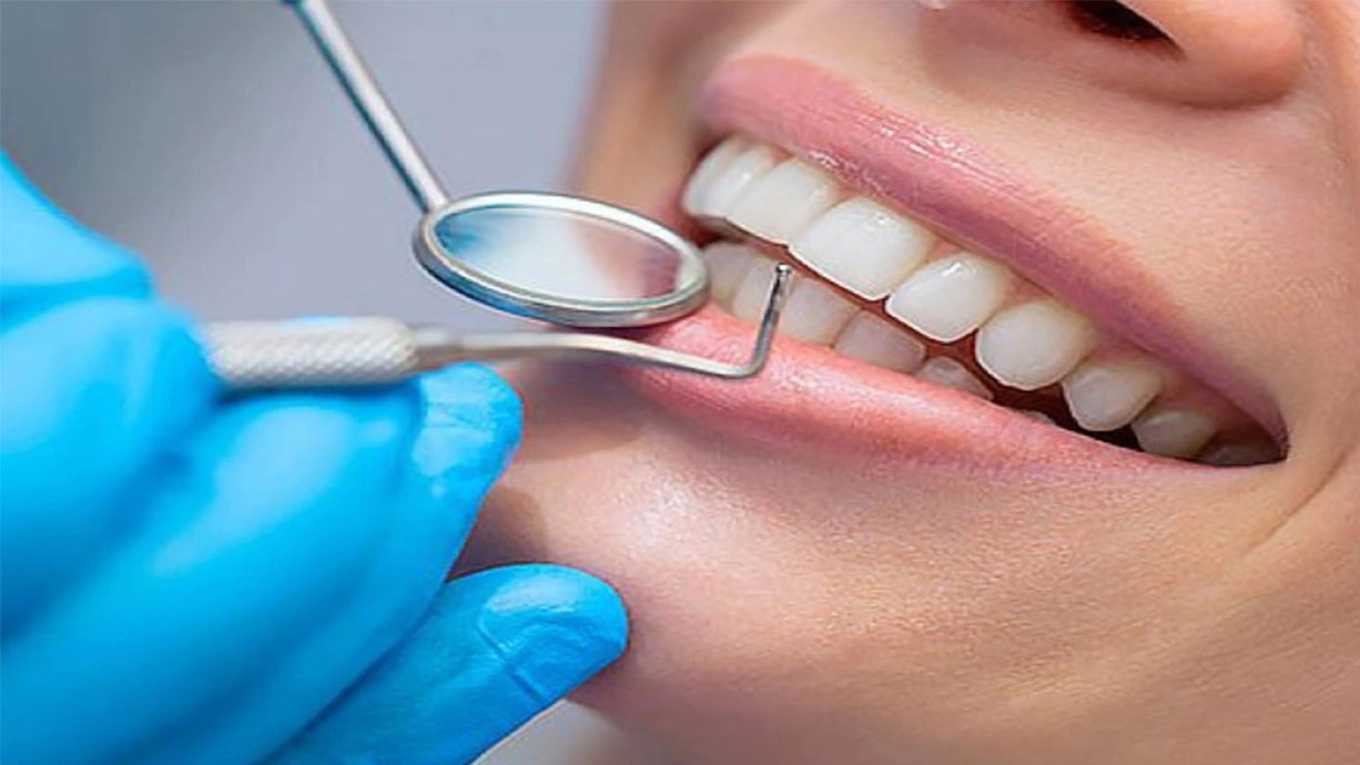 انجام کامپوزیت نانو سرامیک دندان دنتال نیو فیس وان در اندیشه شهریار