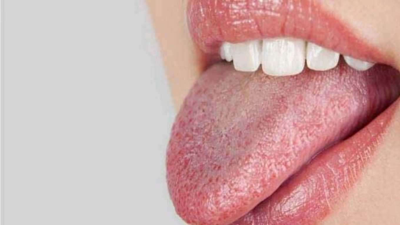 تشخیص بیماری از زبان کاظمی رشت
