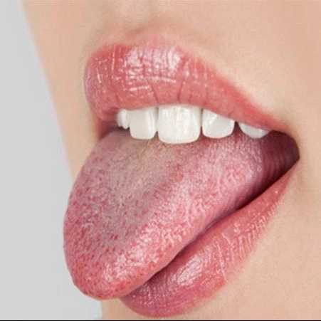 تشخیص بیماری از زبان  کاظمی رشت