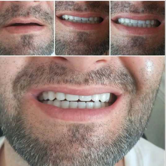 دندان مصنوعی و لابراتوار دندانسازی آرش منبری در سنندج