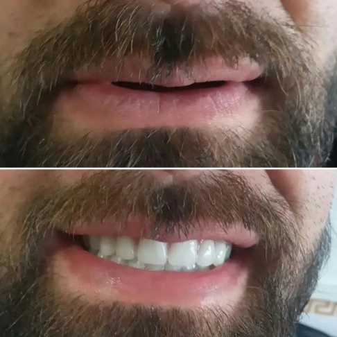 دندان مصنوعی و لابراتوار دندانسازی آرش منبری در سنندج
