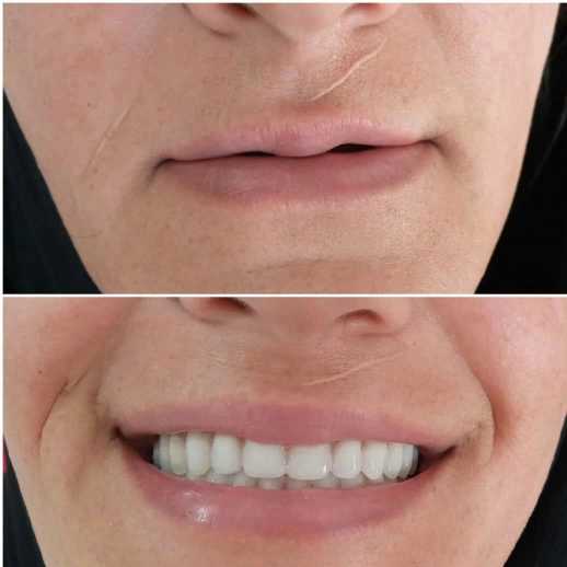 دندان مصنوعی و لابراتوار دندانسازی آرش منبری در سنندج