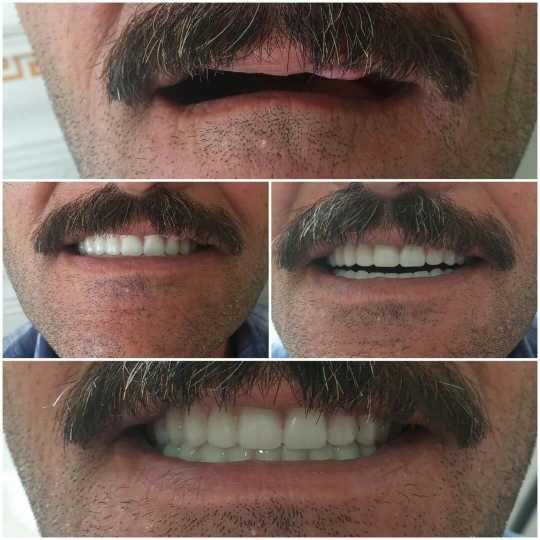 دندان مصنوعی و لابراتوار دندانسازی آرش منبری در سنندج