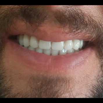 دندان مصنوعی و لابراتوار دندانسازی آرش منبری در سنندج