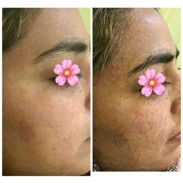 محصولات آرایشی معجزه