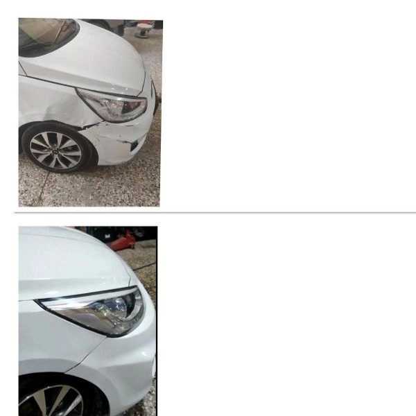 قبل و بعد