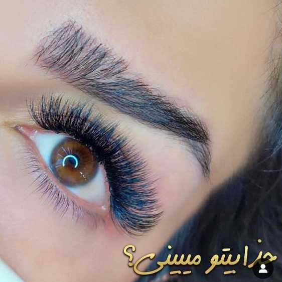 کاشت مژه