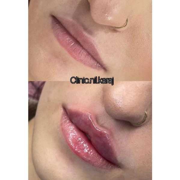 مطب زیبایی نیل