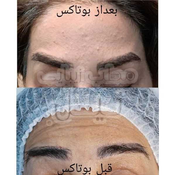 مطب زیبایی نیل