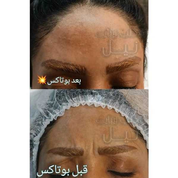 مطب زیبایی نیل