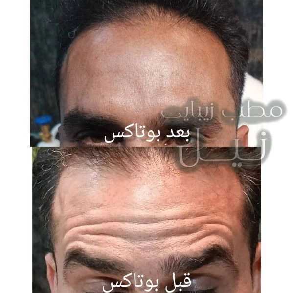 مطب زیبایی نیل