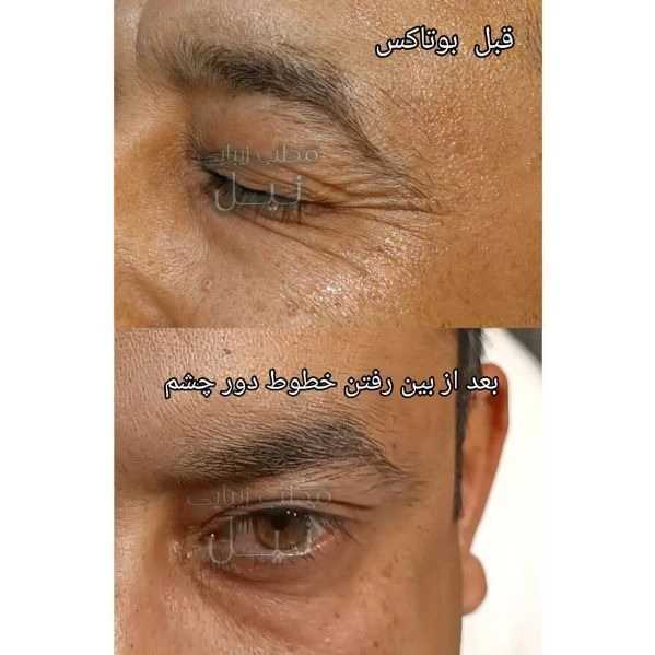 مطب زیبایی نیل