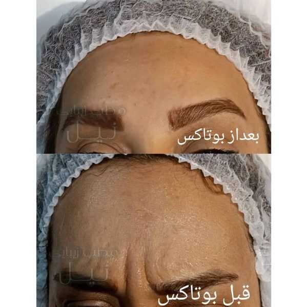 مطب زیبایی نیل