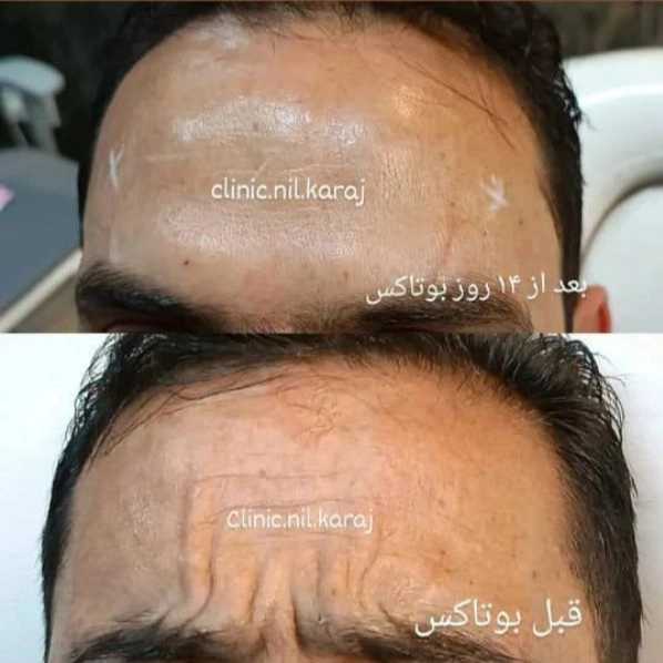 مطب زیبایی نیل