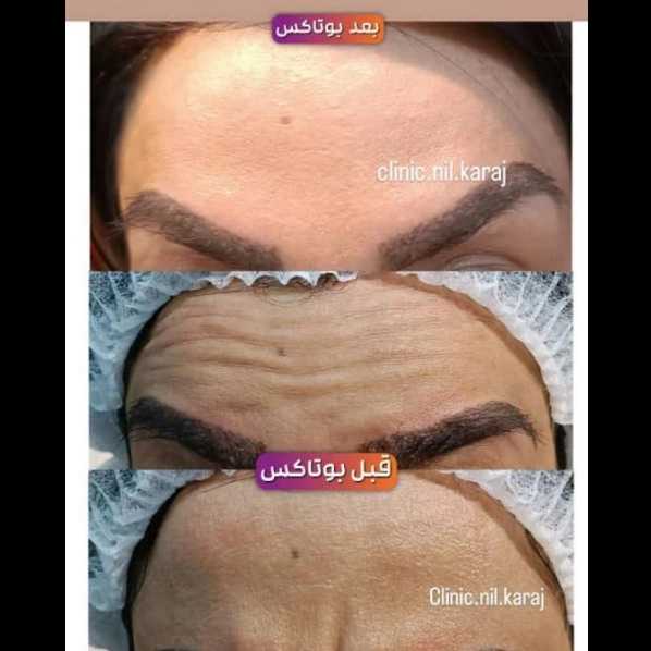 مطب زیبایی نیل