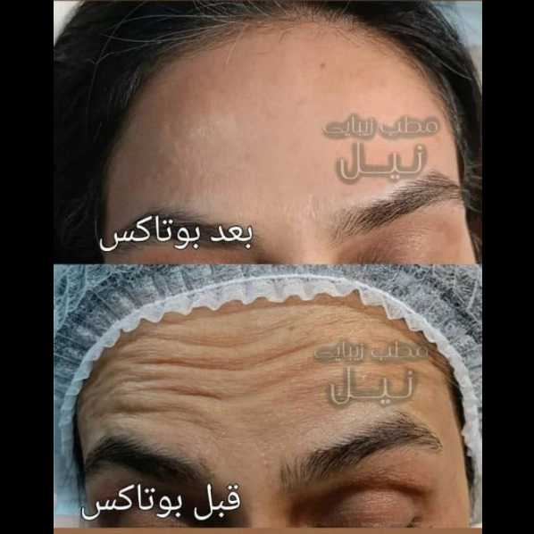 مطب زیبایی نیل