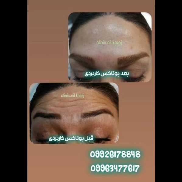 مطب زیبایی نیل