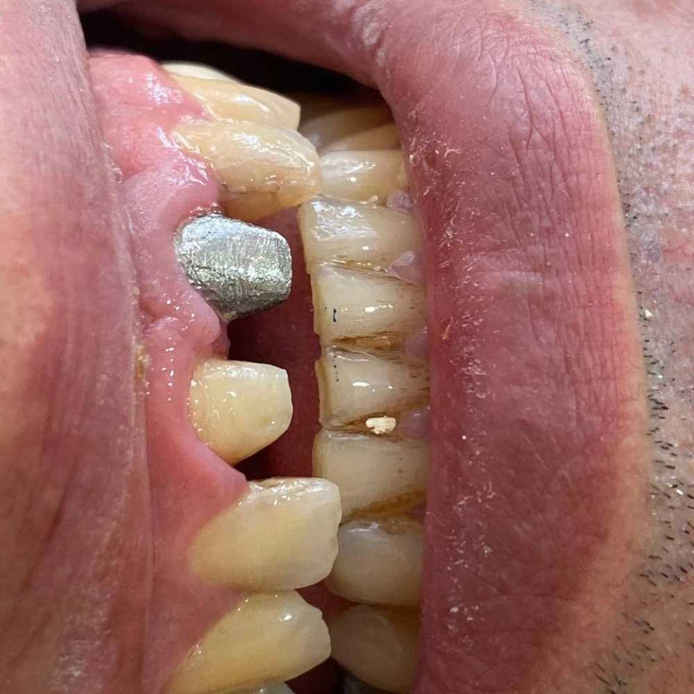 لابراتوار تخصصی پروتز دندان و ایمپلنت علیرضا جمالی