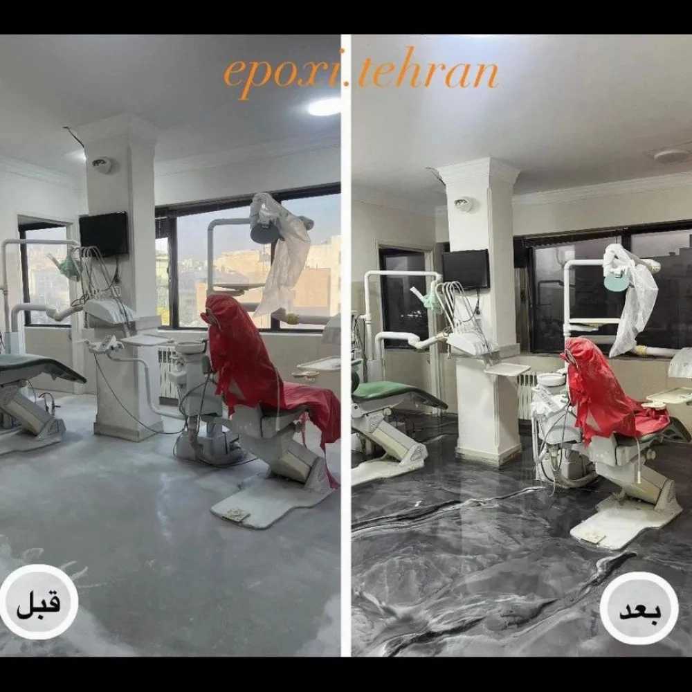 مستر اپوکسی