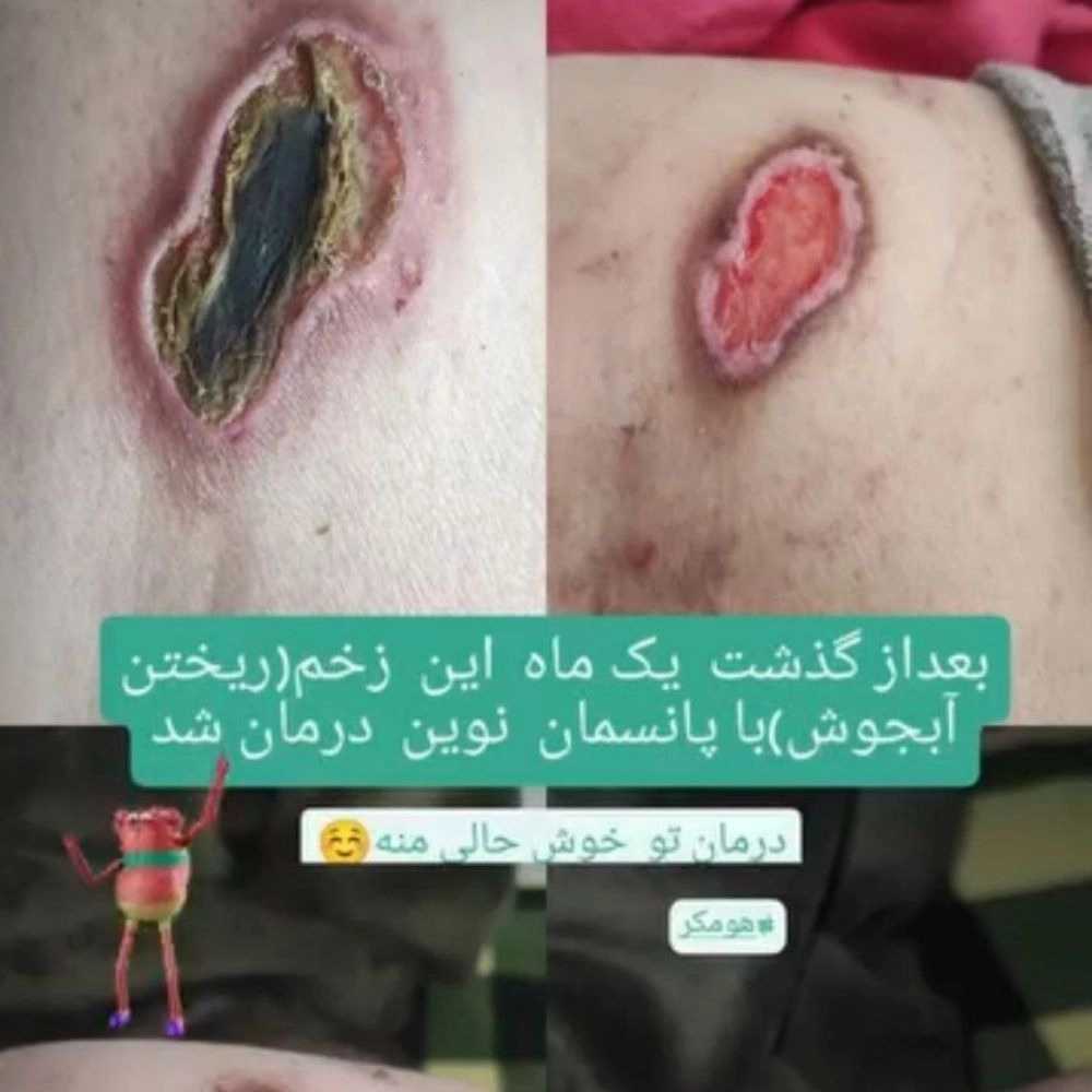 پرستاری در منزل برای سالمندان دیابتی؛ راهکارهای مراقبتی نوین