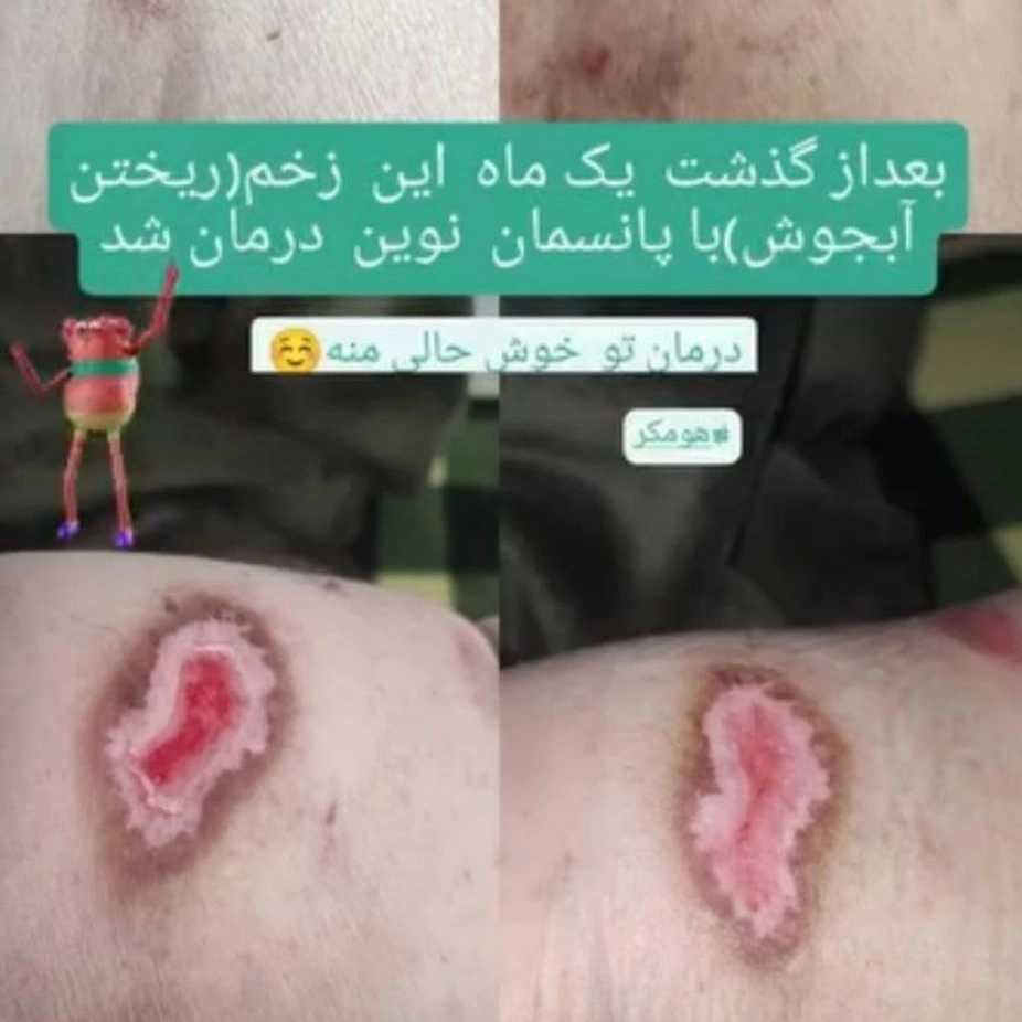 نکات طلایی در مراقبت از بیماران دیابتی در خانه