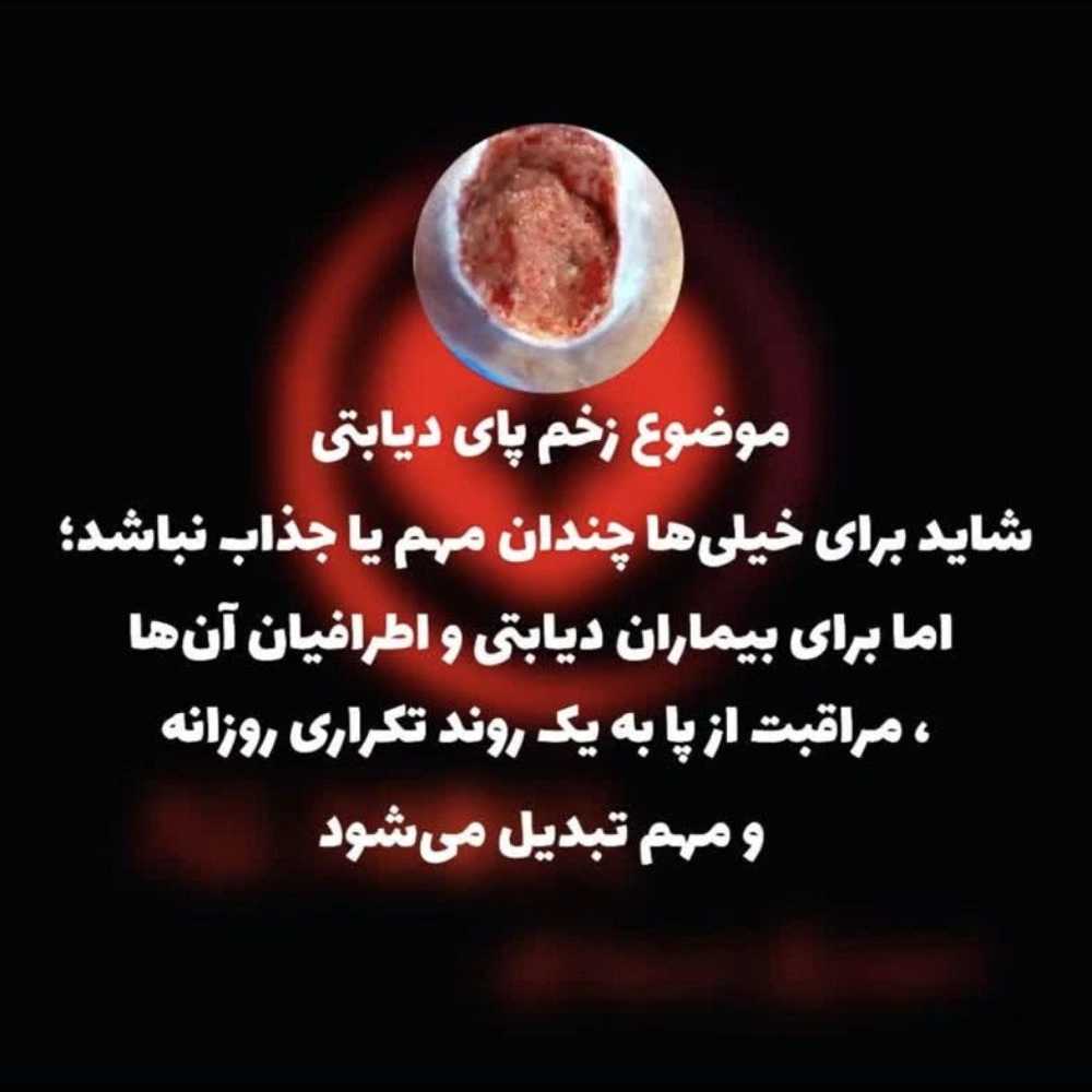 مراقبت پای دیابتی