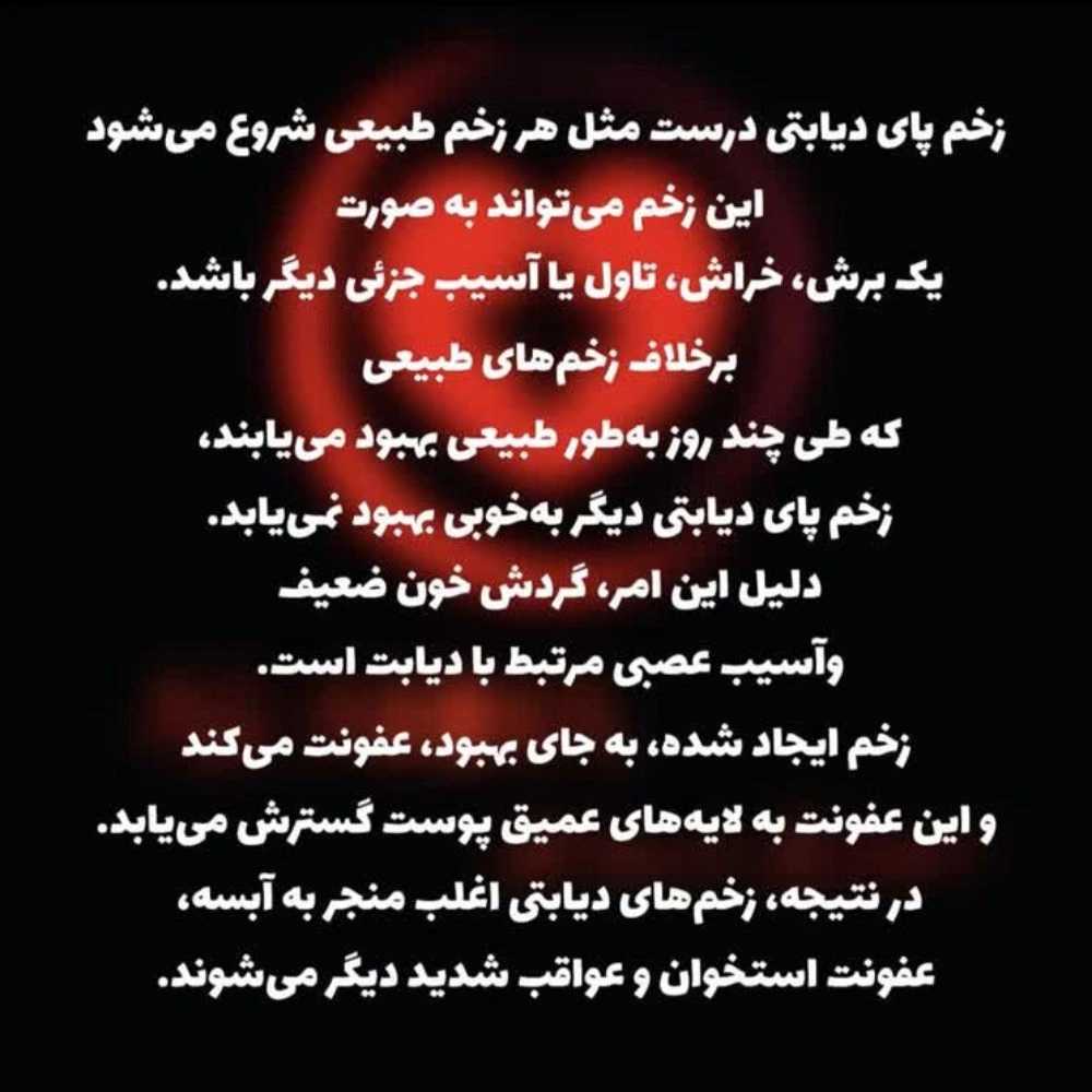 پانسمان زخم دیابتی