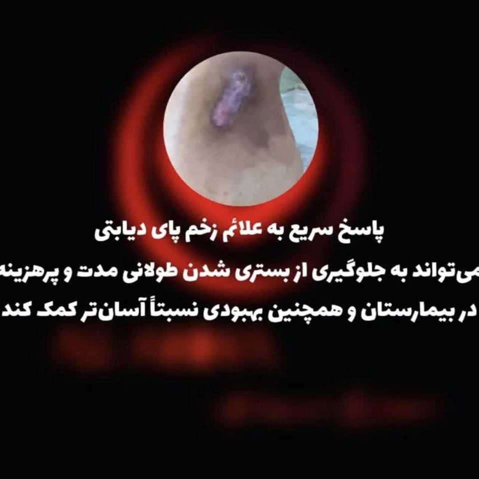 ترمیم زخم دیابت