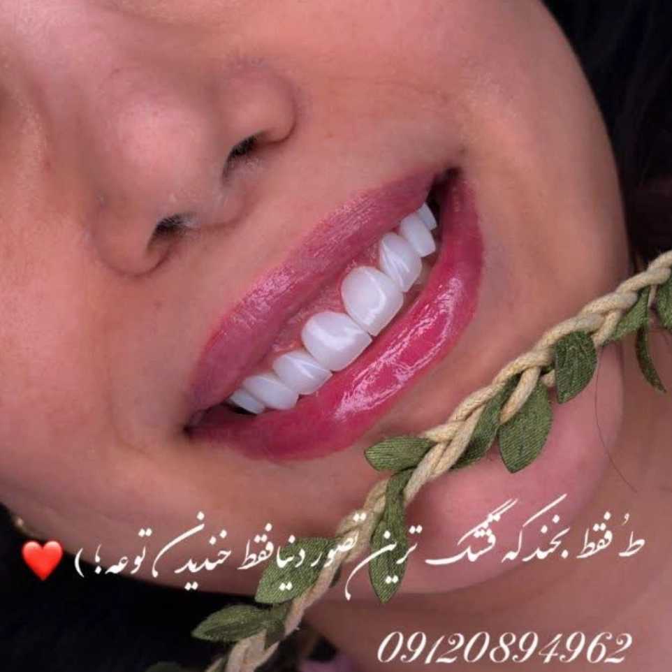 خدمات دندانپزشکی در تهران